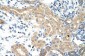 NXF5 antibody - middle region